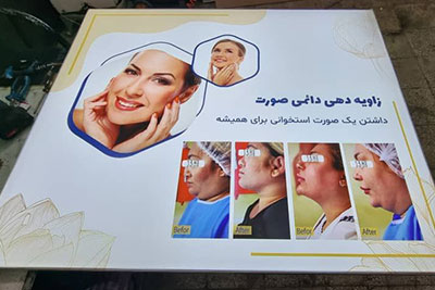 نمونه عکس لایت باکس فریم لس